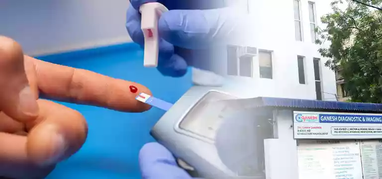 Insulin Test: A Complete Guide Regarding Test Procedure, Uses & Cost